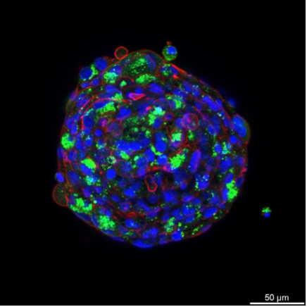 3D Spheroids for Hepatic Fibrosis Model