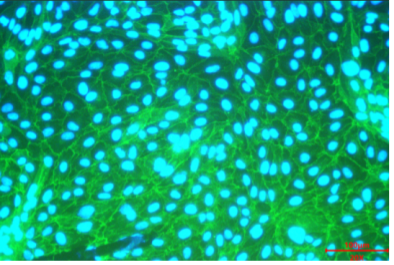 Immunolocalization of β-catenin.png