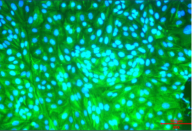 Immunolocalization of CK18.png